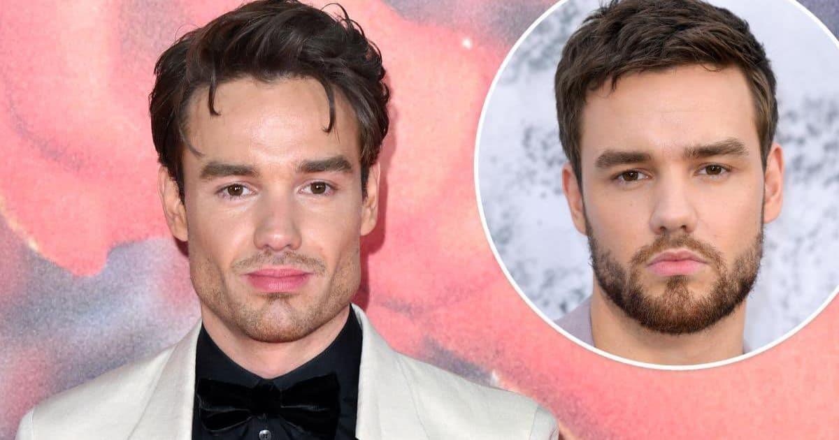 ¿Qué Le Pasó Al Rostro De Liam Payne?