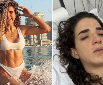 Influencer mexicana sufre infarto cerebral tras aplicación de bótox