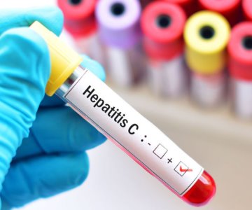 Repuntan casos de Hepatitis C a nivel nacional y estatal