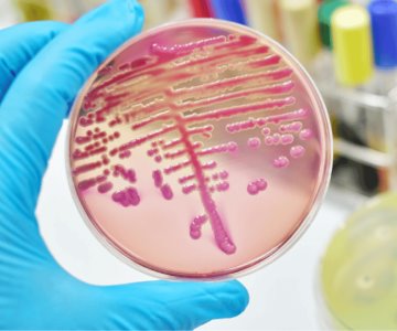 Advierten riesgos para los menores por bacteria Klebsiella oxytoca