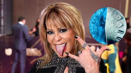 Alejandra Guzmán festeja 37 años de carrera tras cirugía