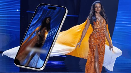 A 15 días de su caída, Miss Jamaica sigue en terapia intensiva