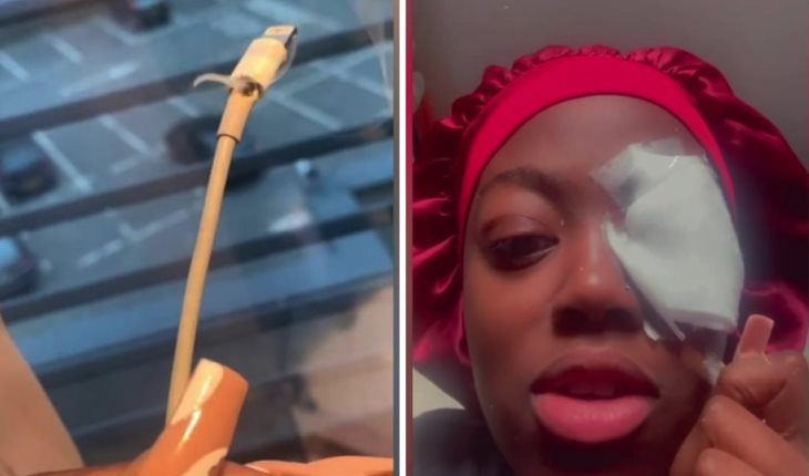 ¡Impactante video! Cargador de teléfono explota y quema el ojo de una joven