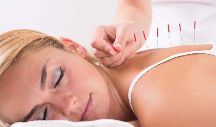 ¿La acupuntura miente? Científico examina la medicina tradicional